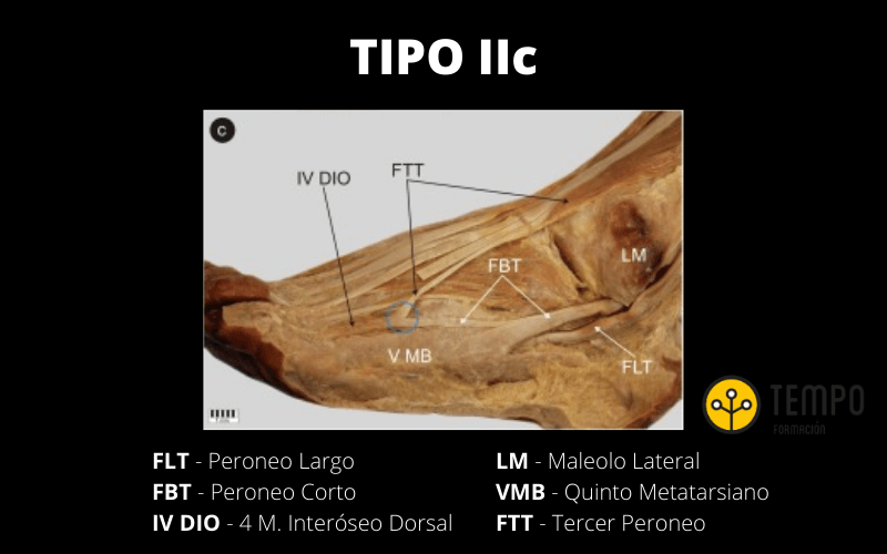 Tipo IIc.png